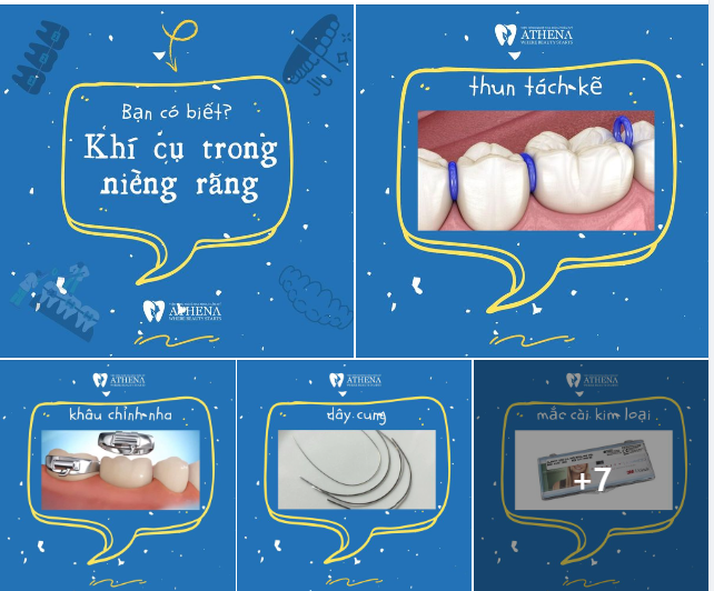 TỔNG HỢP 10 LOẠI KHÍ CỤ KHI NIỀNG RĂNG