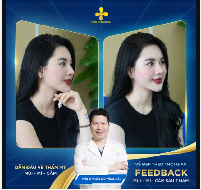 Ngắm feedback cực xinh của chị Quỳnh Trang sau 7 năm nâng mũi - cắt mí - độn cằm tại Thẩm mỹ Như Hoa.