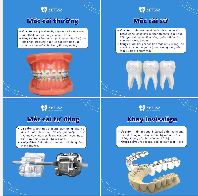 Khám phá Sự Đa Dạng của Niềng Răng: Tìm Lối Dẫn đến Nụ Cười Hoàn Hảo