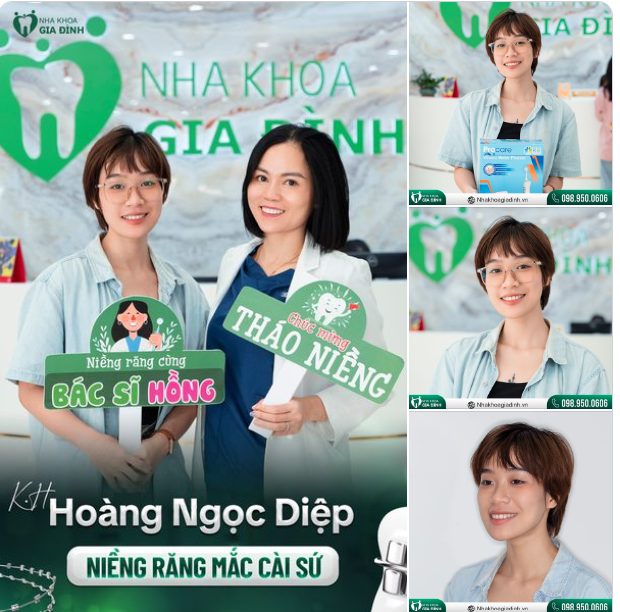 NIỀNG RĂNG LẦN 1 KHÔNG NHƯ KỲ VỌNG, QUYẾT TÂM NIỀNG LẦN 2 NHẬN KẾT QUẢ MỸ MÃN