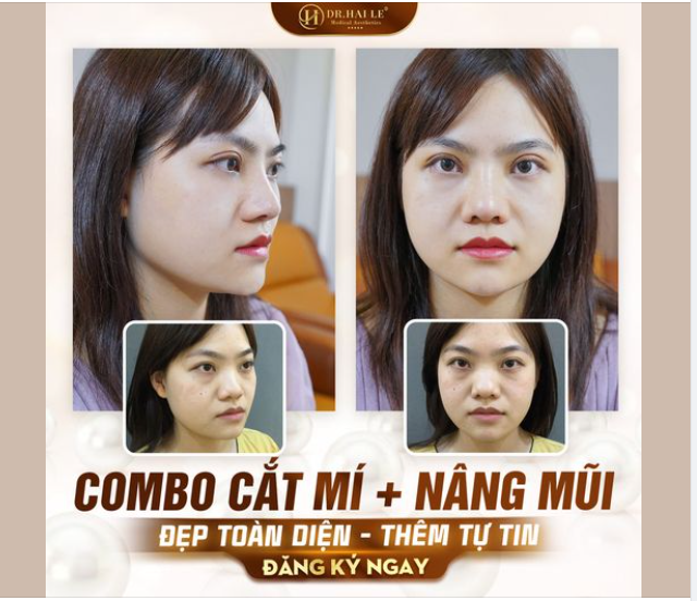 Một chiếc mũi thấp cùng đôi mắt mí lót khiến chị em cảm thấy gương mặt mình chẳng có điểm nào “đáng tiền”?