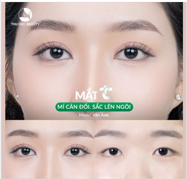 15P xóa sổ tình trạng mắt 1 mí, không cân đối  khí sắc lên ngôi Chọn Mắt TC