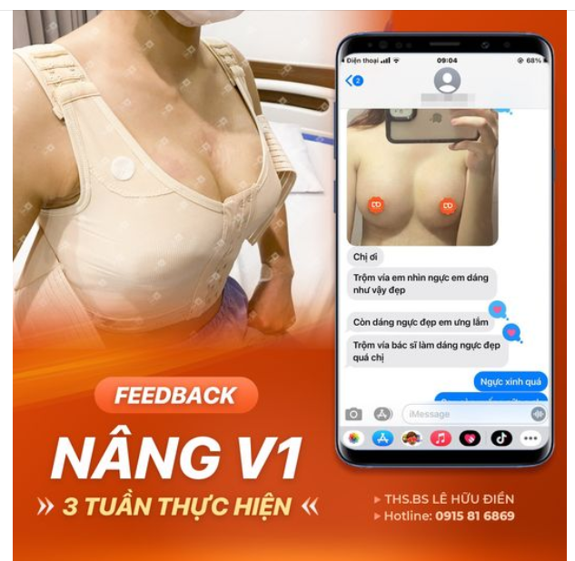 Đầu tuần hứng khởi với Feedback nâng ngực sau 3 tuần thực hiện tại DrD.