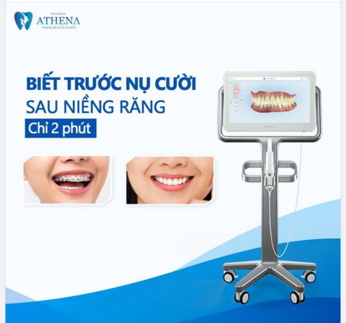 2 PHÚT BIẾT TRƯỚC NỤ CƯỜI SAU NIỀNG RĂNG BẠN CÓ TIN KHÔNG?