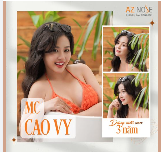 Visual rạng rỡ sau 3 năm nâng mũi