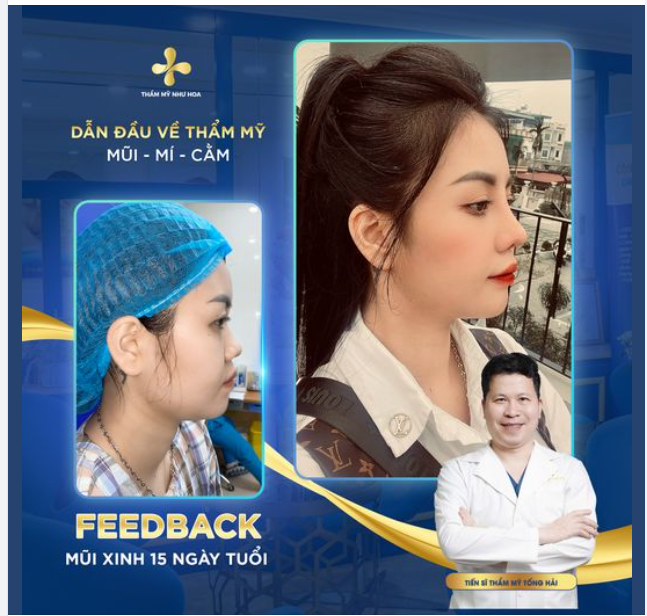 Khách hàng mong muốn dáng mũi của cô đồng Diệu Minh Châu và cái kết