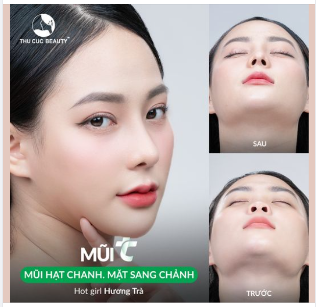 Sở hữu dáng mũi cao bay sau 30P cùng Mũi TC