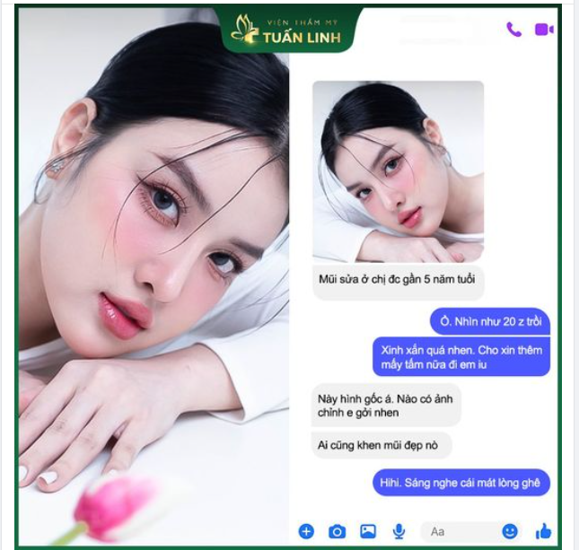 "Mũi đã sửa bên chị được gần 5 năm tuổi rồi... Ai cũng khen mũi đẹp ạ !!" Feedback nâng mũi của cô khách hàng xinh đẹp nhà Tuấn Linh đó ạ!!