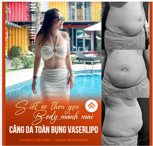VÒNG EO NÀY 0 ĐIỂM, NHƯNG LÀ KHÔNG ĐIỂM NÀO ĐỂ CHÊ