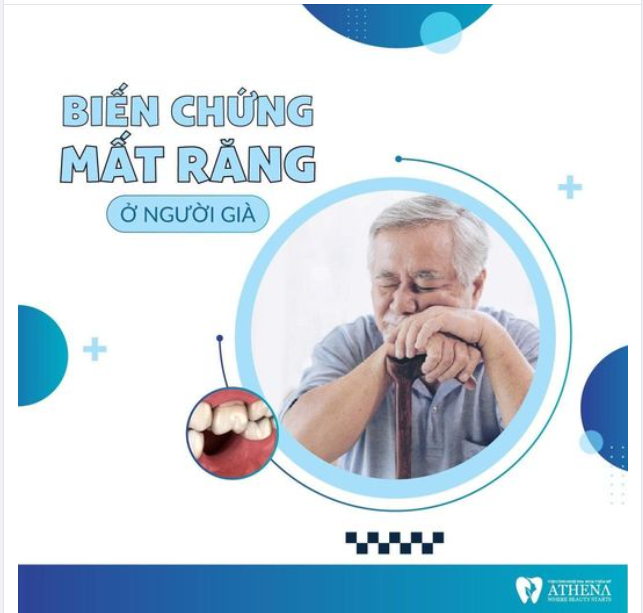 ĐỪNG XEM NHẸ VIỆC MẤT RĂNG LÂU NĂM Ở NGƯỜI GIÀ!!