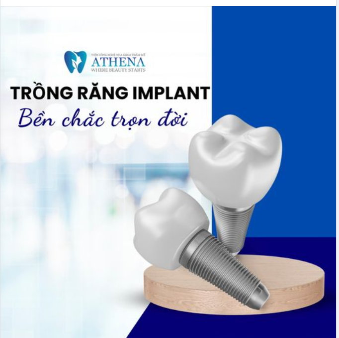 TRỒNG IMPLANT - GIẢI PHÁP HIỆU QUẢ CHO MẤT RĂNG