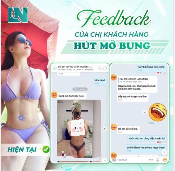 FEEDBACK SIÊU XỊN TỪ CHỊ KHÁCH BODY CHỮ S CỰC CHUẨN SAU HÚT MỠ BỤNG