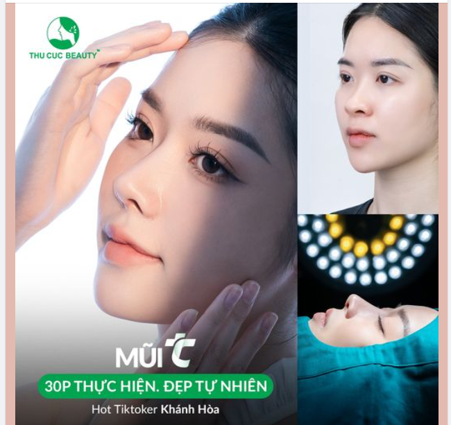 30P xóa sổ sống mũi thấp, đầu mũi to bè cùng Mũi TC
