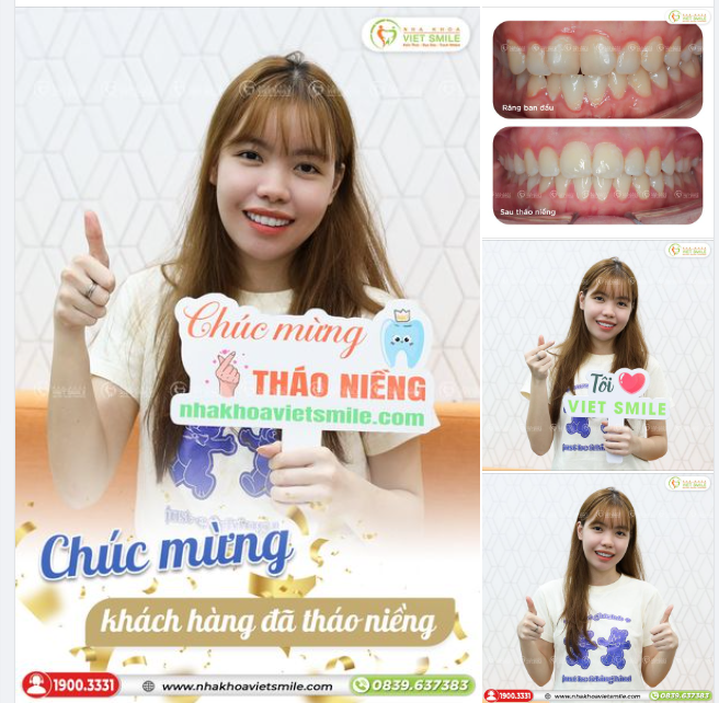 CHÚC MỪNG KHÁCH HÀNG ĐÃ THÁO NIỀNG