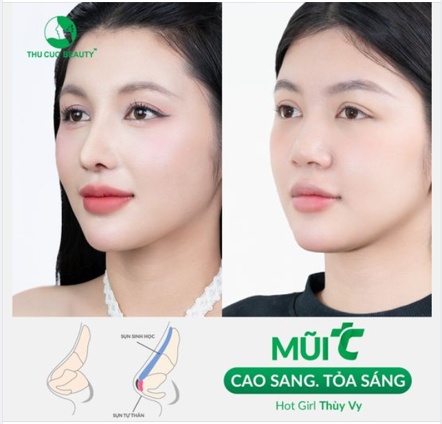 Đẹp tự nhiên. 5 ngày vào form