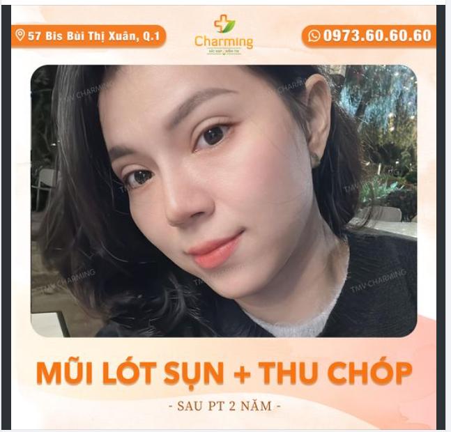 Hai năm như phút ban đầu. Lót sụn, thu chóp vẫn ngầu, vẫn duyên