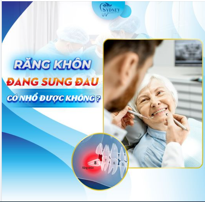 RĂNG KHÔN ĐANG SƯNG ĐAU CÓ NHỔ ĐƯỢC KHÔNG?