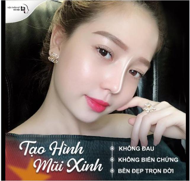 TÁI TẠO GÓC NGHIÊNG THẦN THÁNH CHỈ SAU 45P NÂNG MŨI