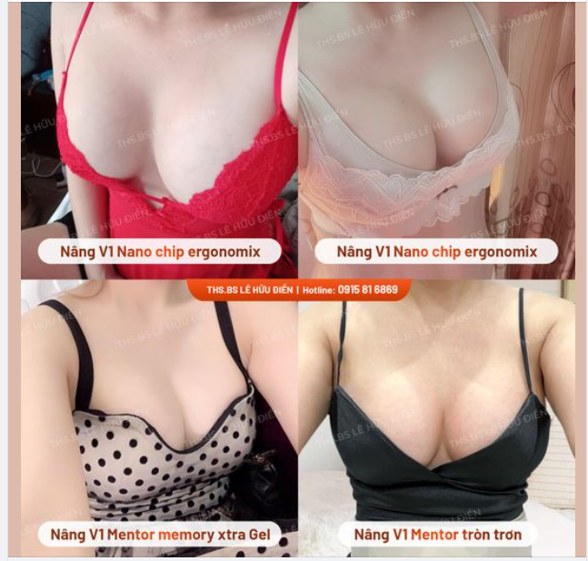 TỔNG HỢP CÁC DÁNG NGỰC TẠI DrD ️