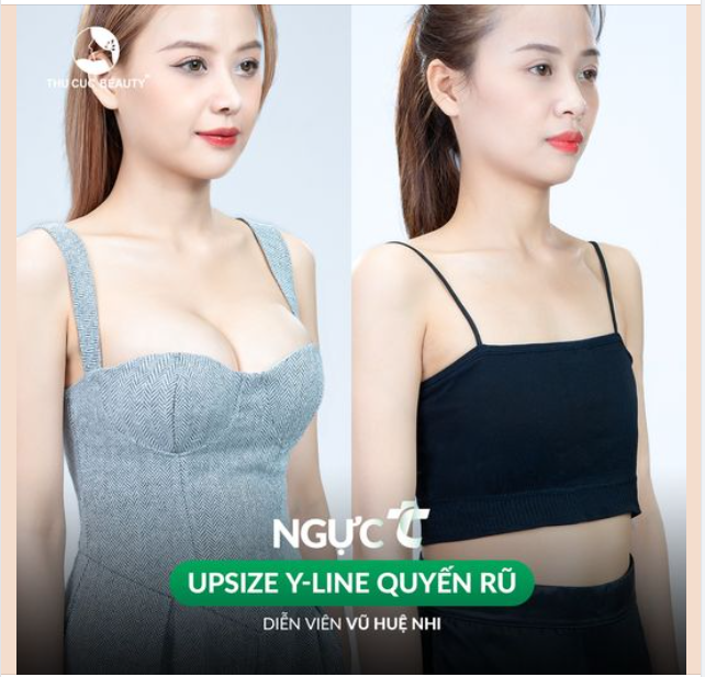 Tạm biệt V1 teo lép chỉ sau 60P cùng Ngực TC