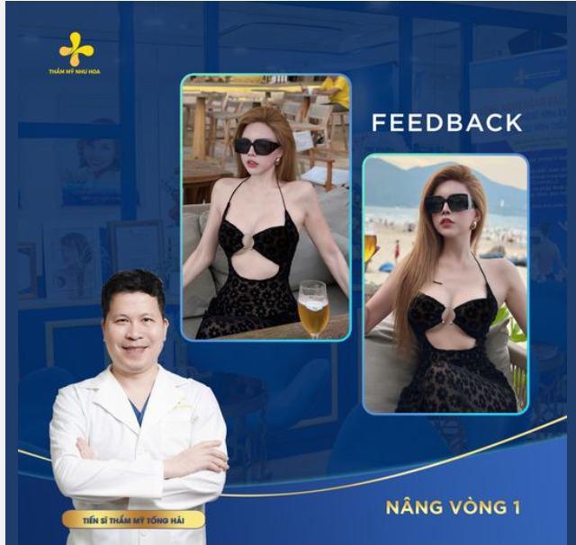 Feedback nâng V1: Sau nhiều năm vẫn khiến người đối diện phải say đắm.