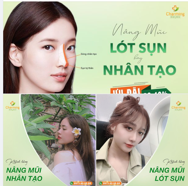 SỰ KHÁC NHAU CỦA NÂNG MŨI LÓT SỤN VÀ NÂNG MŨI NHÂN TẠO