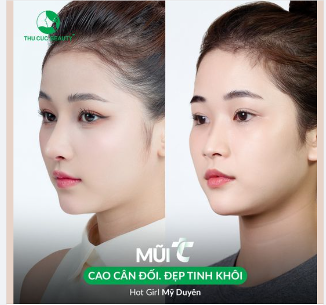 10 suất Mũi TC -30% làm đẹp trong tháng 5