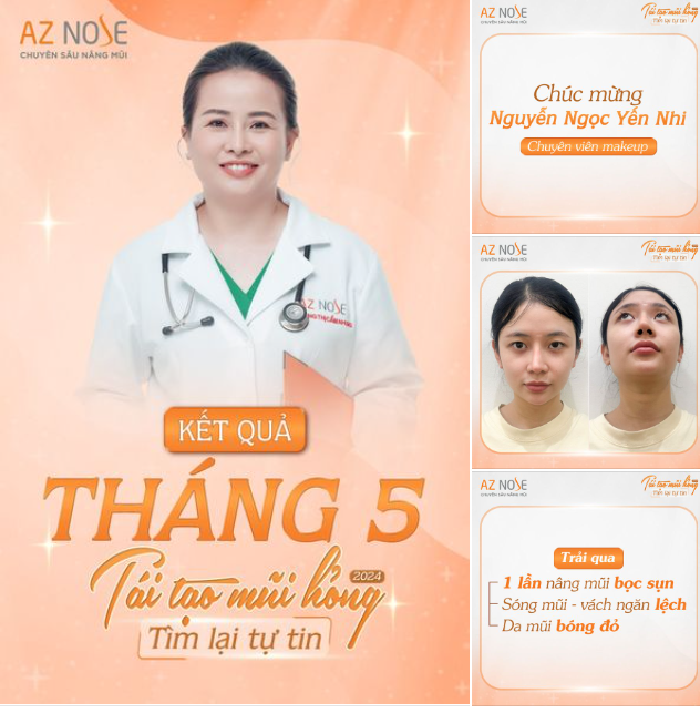 Chúc mừng khách hàng thứ 2 của chương trình "TÁI TẠO MŨI HỎNG" 2024