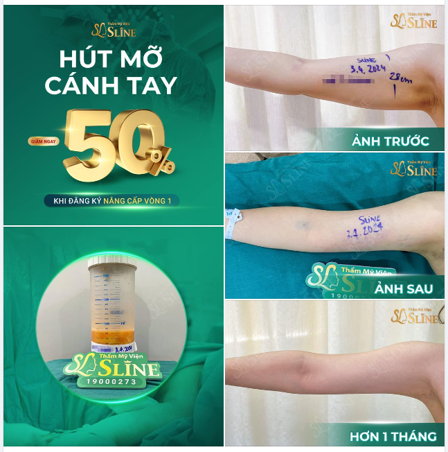 THÁNG 5 SĂN DEAL CỰC HIẾM