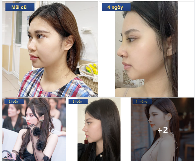 “Nếu có 100 điểm thì em sẽ cho bác sĩ Hải 100 điểm”