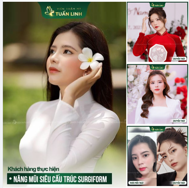 Xóa bỏ khuyết điểm mũi xấu - Tìm lại sự tự tin để thành công tỏa sáng!!