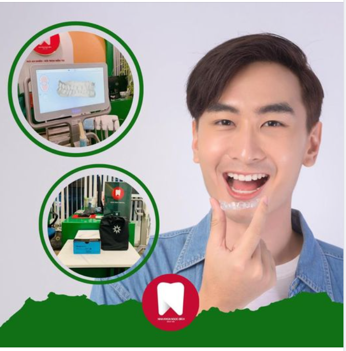 RÚT NGẮN THỜI GIAN NIỀNG RĂNG TỪ 4-6 THÁNG CÙNG VỚI INVISALIGN