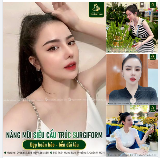 Mũi siêu cấu trúc Surgiform - Luôn là sự lựa chọn hoàn hảo nhất cho một dáng mũi bền đẹp dài lâu.