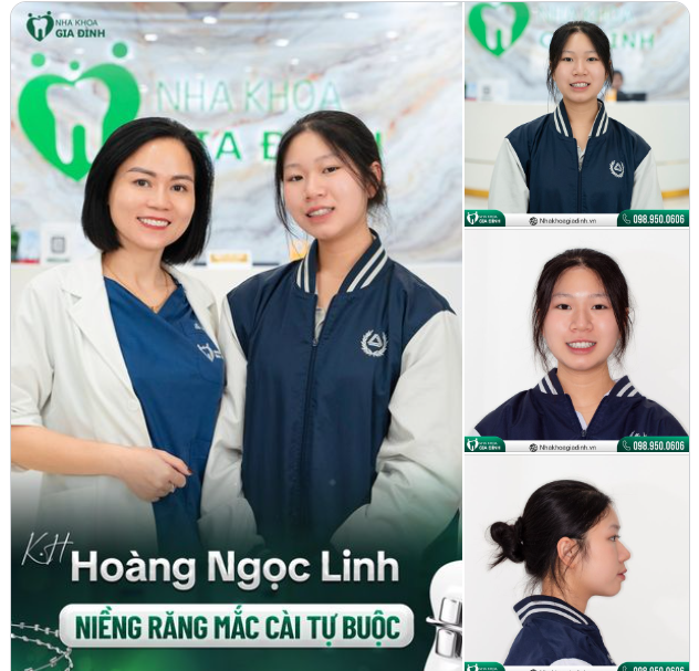 SAU 1,5 NĂM ĐEO NIỀNG, CÔ GÁI 17 TUỔI TỰ TIN VỚI NỤ CƯỜI MỚI XINH TƯƠI, RẠNG NGỜI