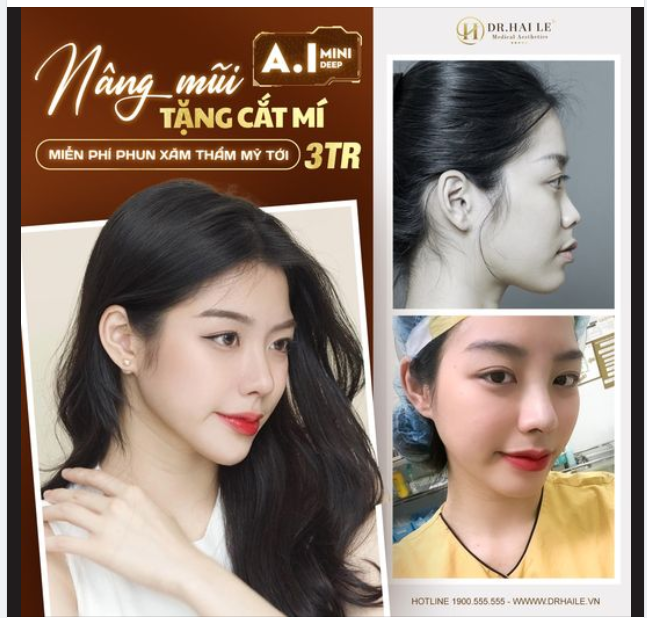 Nâng mũi tặng cắt mí A.I Mini Deep