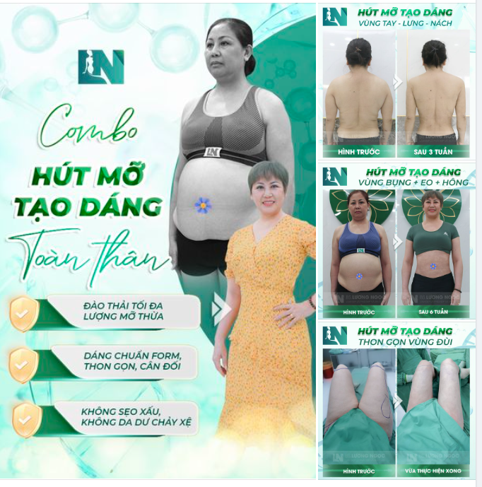 HÚT MỠ TẠO DÁNG TOÀN THÂN - LỰA CHỌN HOÀN HẢO CỦA CHỊ EM PHỤ NỮ