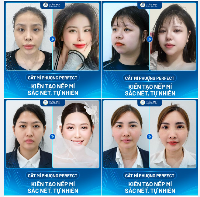 CẮT MÍ PHƯỢNG BAY ĐẸP TỰ NHIÊN