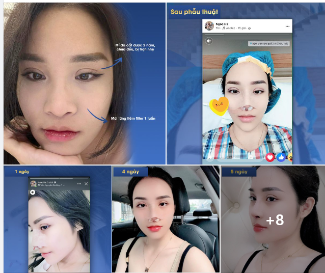 HÀNH TRÌNH THAY ĐỔI CỦA NỮ ĐIỀU DƯỠNG NHA KHOA NGỌC HÀ ĐẾN TỪ HẢI DƯƠNG