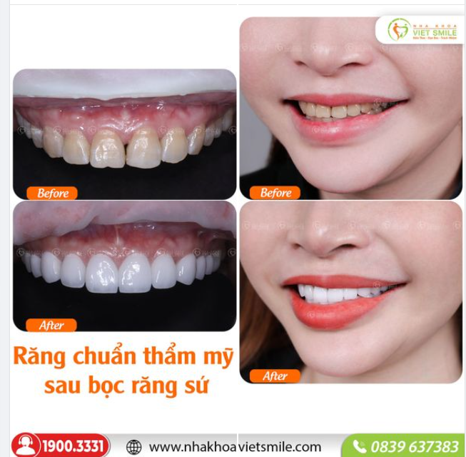 MÀU RĂNG MỚI - NỤ CƯỜI MỚI - TỰ TIN LÀ CHÍNH MÌNH