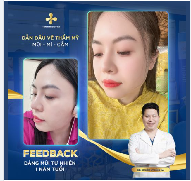 Khi dáng mũi đẹp quyết định đến 70% nhan sắc của bạn
