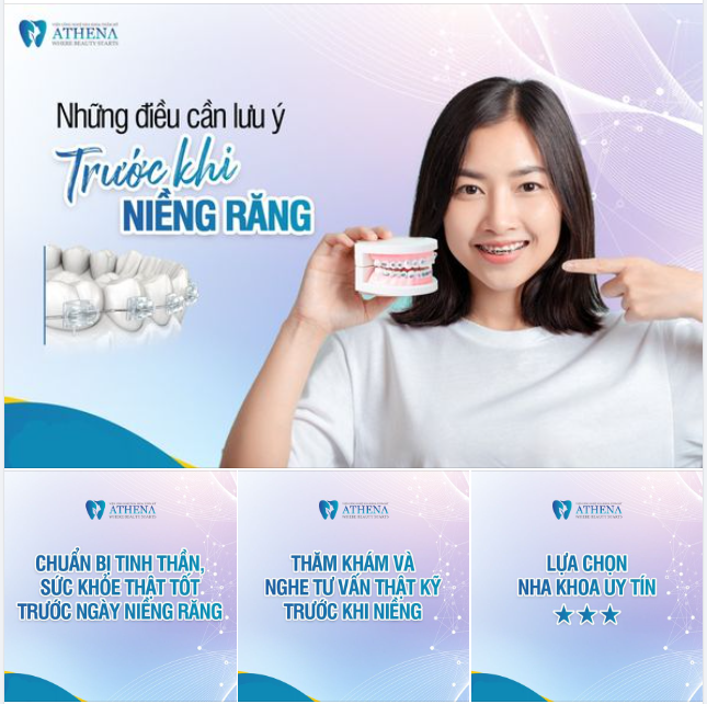 NHỮNG ĐIỀU CẦN LƯU Ý TRƯỚC KHI NIỀNG RĂNG