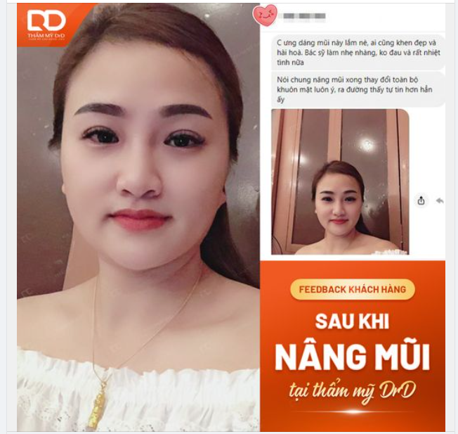 FEEDBACK KHÁCH HÀNG SAU KHI LÀM MŨI TẠI DRD.