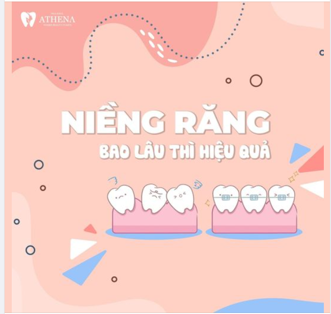 NIỀNG RĂNG BAO LÂU THÌ HIỆU QUẢ?