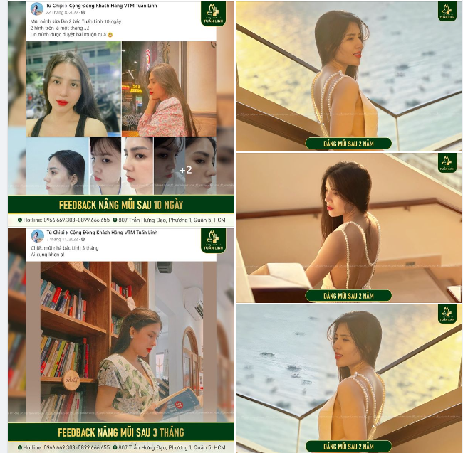 ​​​​​​​ Feedback khách hàng Nâng mũi cấu trúc tại Tuấn Linh!!