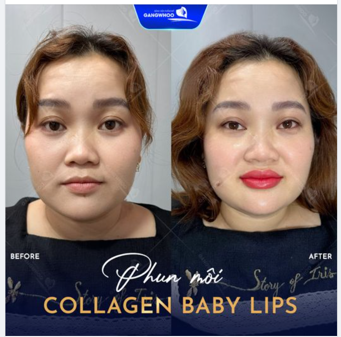 PHUN MÔI COLLAGEN BABY LIPS