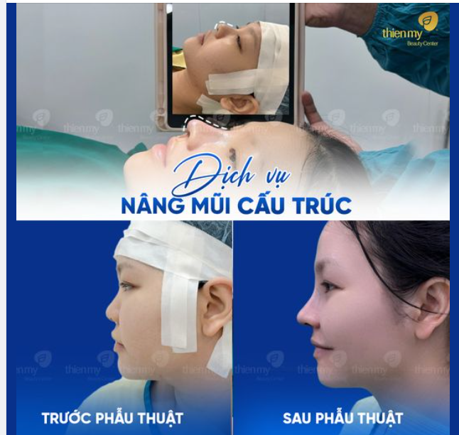 Vừa nhìn cứ tưởng xinh, ai dè nhìn kĩ lung linh quá trời..