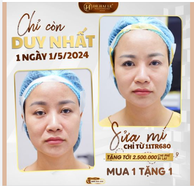 Loạt ưu đãi đặc biệt vô cùng hấp dẫn chỉ có tại Dr.Hải Lê chào mừng Đại Lễ chỉ CÒN 1 NGÀY DUY NHẤT, chị em rinh ngay kẻo lỡ!