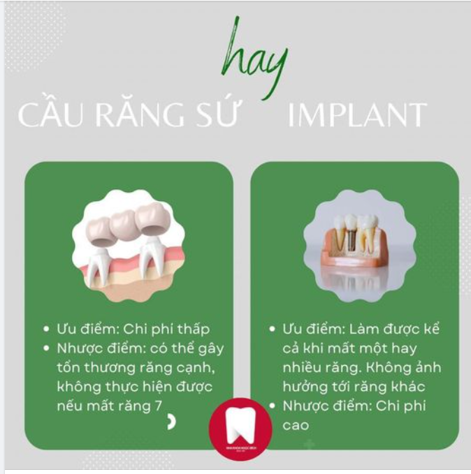 NÊN TRỒNG RĂNG BẰNG CẦU RĂNG SỨ HAY CẤY GHÉP IMPLANT?