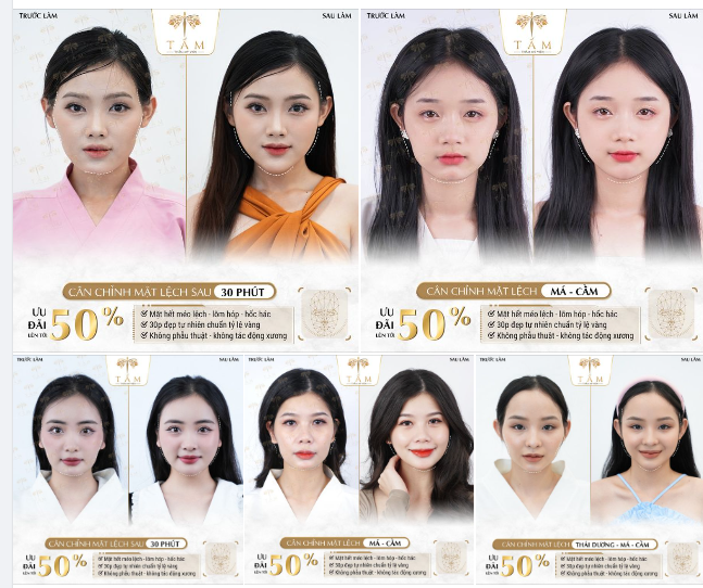 SỰ THAY ĐỔI NÀY CÓ KHIẾN NÀNG NÓNG LÒNG ĐI LÀM ĐẸP KHÔNG Ạ?