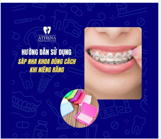 HƯỚNG DẪN SỬ DỤNG SÁP NHA KHOA ĐÚNG CÁCH KHI NIỀNG RĂNG
